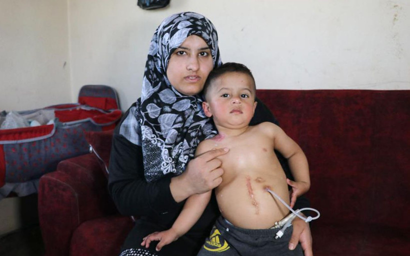 Adana'da yemek borusu olmayan Muhammed'in içtiği sıvılar boynundan fışkırıyor - Resim: 3