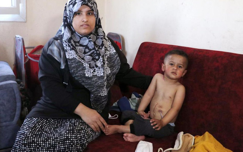 Adana'da yemek borusu olmayan Muhammed'in içtiği sıvılar boynundan fışkırıyor - Resim: 1