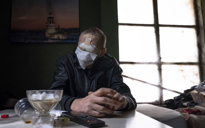 Bir siğille başladı yüzünü kaybetti! Konyalı baba çay içmeye ve kızını öpmeye hasret kaldı - Resim: 1