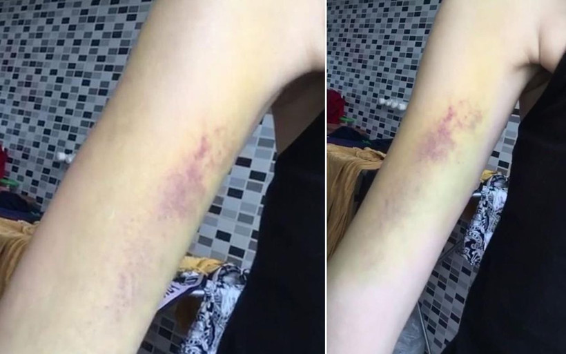 Antalya'da genç Gülsüm'e 'Neden saçını kestin' dayağı! Ölüm korkusunu ağlayarak anlattı - Resim: 3