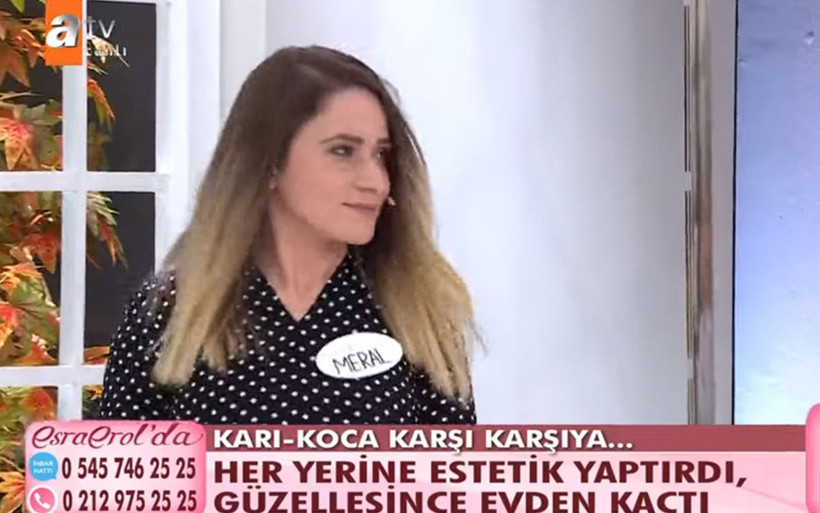 İneklerini satıp yaptırmıştı! Yalçın Okur, estetik sonrası kaçan eşi Meral ile Esra Erol'da yüzleşti - Resim: 4