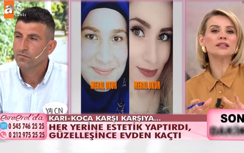 İneklerini satıp yaptırmıştı! Yalçın Okur, estetik sonrası kaçan eşi Meral ile Esra Erol'da yüzleşti - Resim: 2