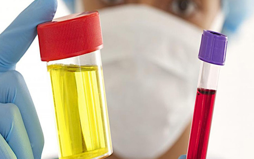 İdrardan kan gelmesi nedenleri ve tedavisi - Resim: 3