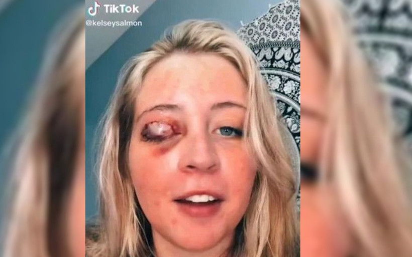 Güzelleşmek için gitmişti göz kapağını bıraktı! ABD'de köpek saldırısı dehşeti - Resim: 3