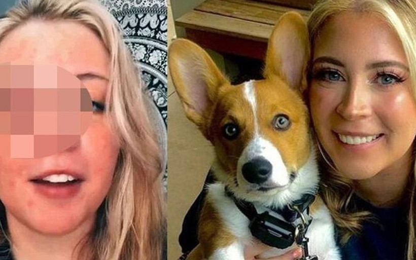 Güzelleşmek için gitmişti göz kapağını bıraktı! ABD'de köpek saldırısı dehşeti - Resim: 1