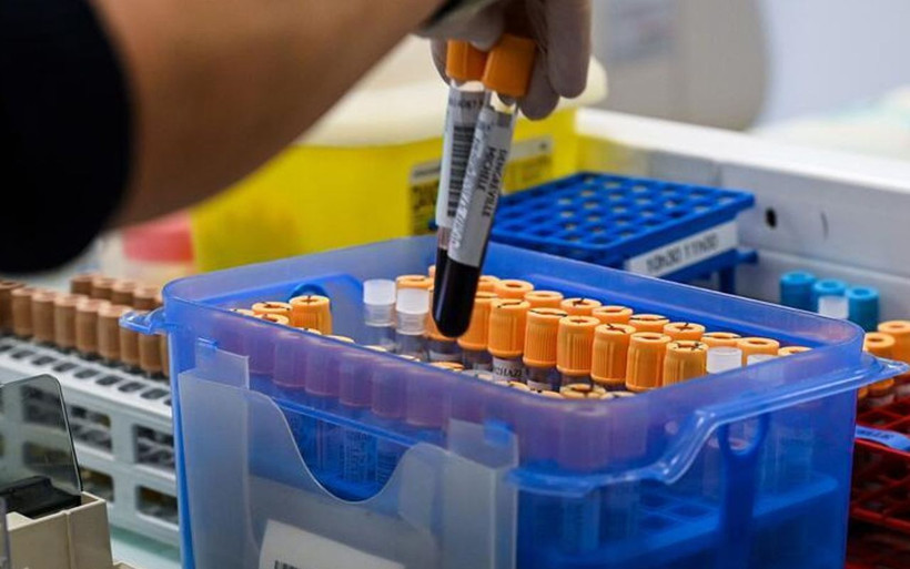 'Virüs insan yapımı' deyip Çin'den kaçmıştı! O viroloğun sözleri dünyayı bir kez daha sarstı - Resim: 2