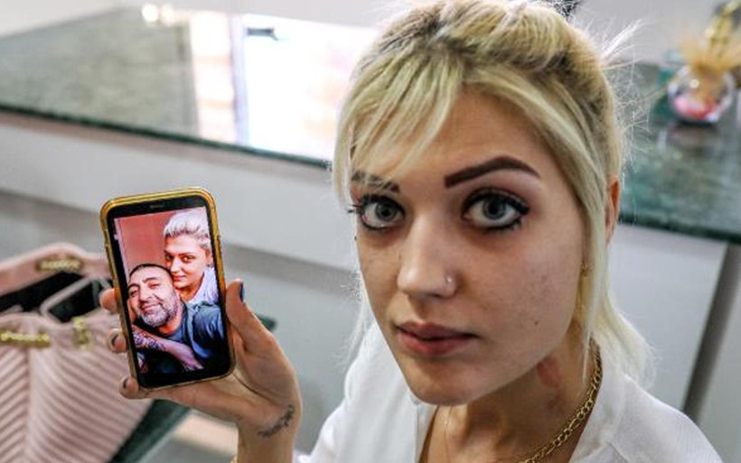 Ensesinden vurulan Zeliha diken üstünde sevgilisi cezaevinde anlatmış! - Resim: 1