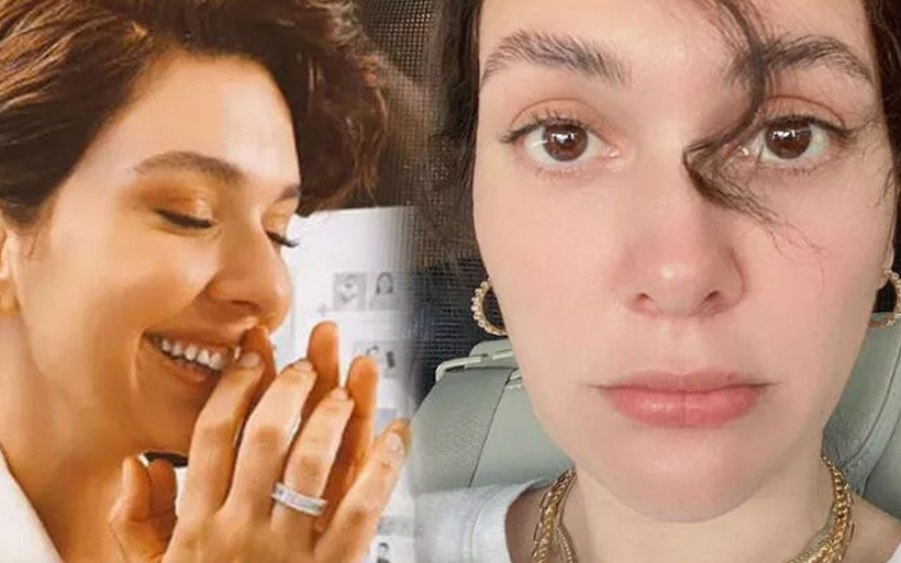 Bergüzar Korel takipçilerinden rica etti: Lütfen bana bunu yapmayın! - Resim: 4