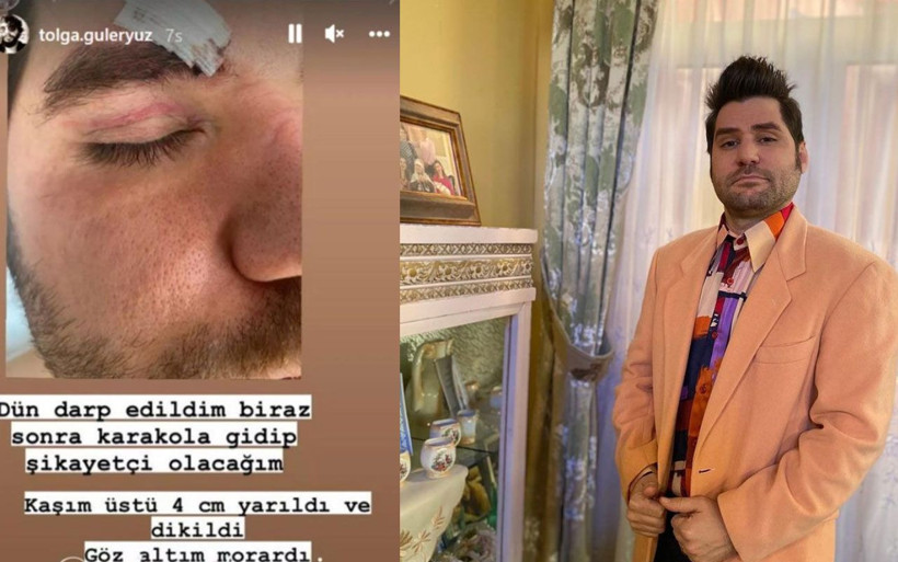 TRT1 Seksenler'in Şahin'i Ceyhun Fersoy'a gittiği mekanda saldırı! Darp edildi - Resim: 2