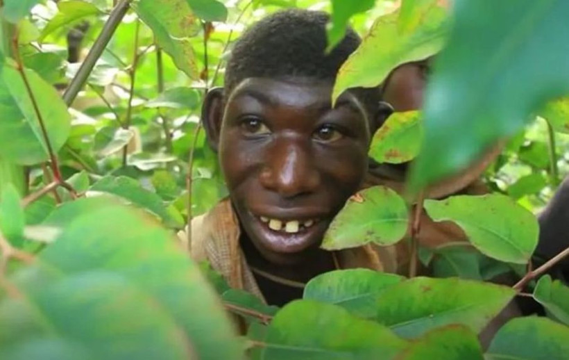 Görünüşü sebebiyle dışlanıp ormanda yaşayan genç köyüne döndü - Resim: 1