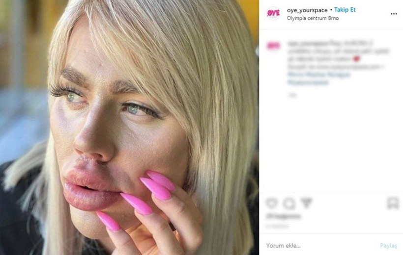 Honza Simsa Barbie'ye benzemek için binlerce lira harcadı bu haliyle hedefine ulaşmış - Resim: 3