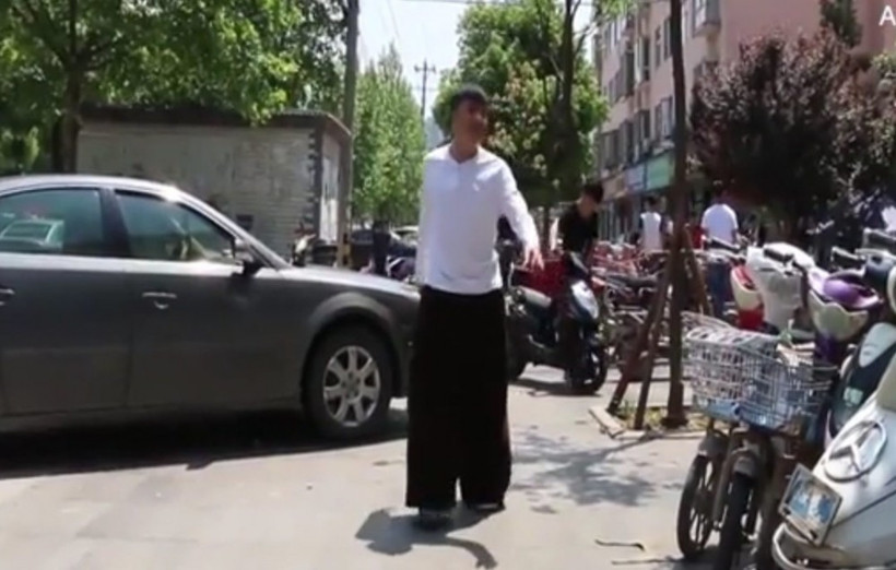 Sivrisinek ısırığı deyip geçmeyin bacağı öyle bir hale geldi ki... - Resim: 3