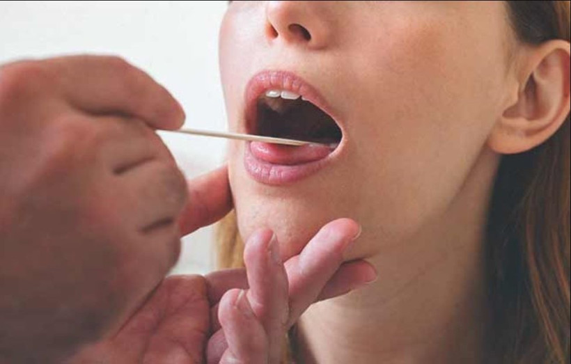 Damak yarasına ne iyi gelir buz yöntemini deneyin! - Resim: 2