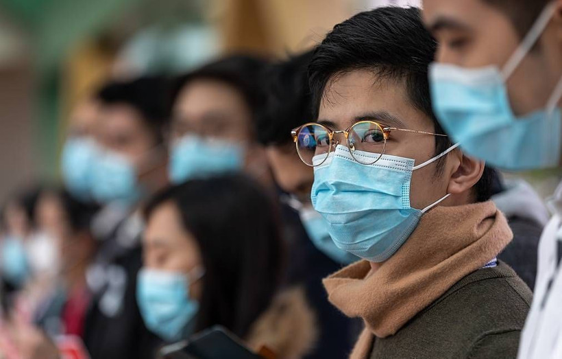 Bilim insanları açıkladı! Gözlük takanlar 5 kat daha az koronavirüse yakalanıyor - Resim: 4