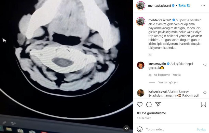 Kısmetse Olur Mehtap Taşkıran'ın kızı öz dede istismarı sonrası felç geçirmiş! - Resim: 3