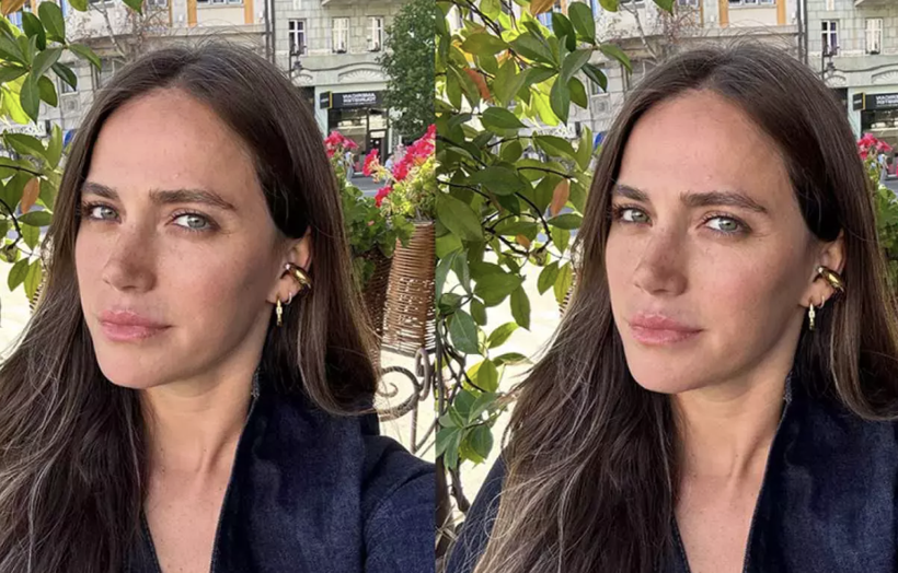 Ağrıları ile baş etmeye çalışıyordu! Ceyda Ateş'ten yeni açıklama - Resim: 3