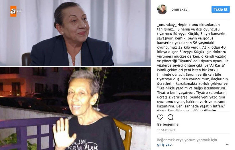 Usta oyuncudan kötü haber bir deri bir kemik kaldı! - Resim: 3