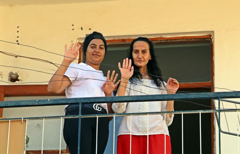 Dil kanserine yakalandı, bacağından parça alıp yeni dil yapıldı - Resim: 3