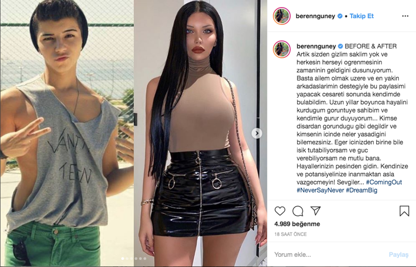 Futbolcuları ifşa eden Beren Güney cinsiyet değiştirdiğini itiraf etti eski hali olay - Resim: 2