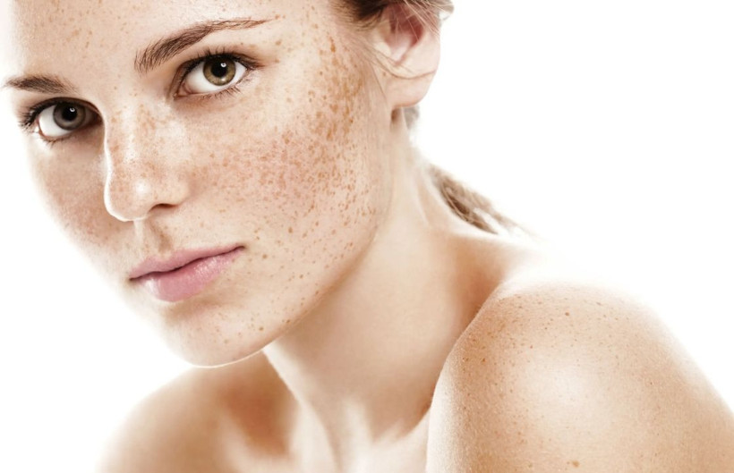 Vücuttaki güneş lekelerinden kurtulmanız için 12 mucizevi yöntem! - Resim: 4