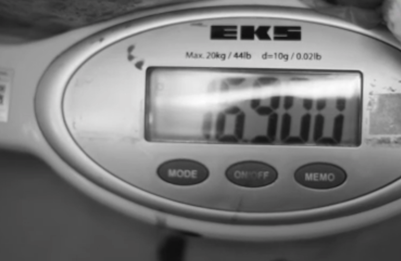 Karnından öyle bir şey çıktı ki doktorlar bile şaşkına döndü! 65 kilo olarak girdiği ameliyattan 48 kilo çıktı - Resim: 4