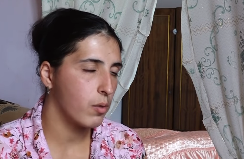 Doktorlar çare bulamadı gözünden yaş yerine kristal damlıyor - Resim: 2