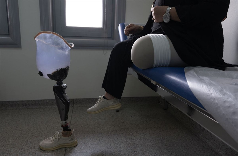 15 Temmuz'da eşini kendisi de bacağını kaybetti kızı 8 yıldır ona anne oldu - Resim: 4