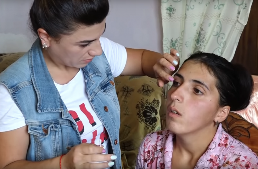 Doktorlar çare bulamadı gözünden yaş yerine kristal damlıyor - Resim: 4