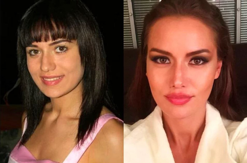 Cansu Dere Demet Özdemir ve Esra Bilgiç'in estetiksiz hallerine bakın - Resim: 4