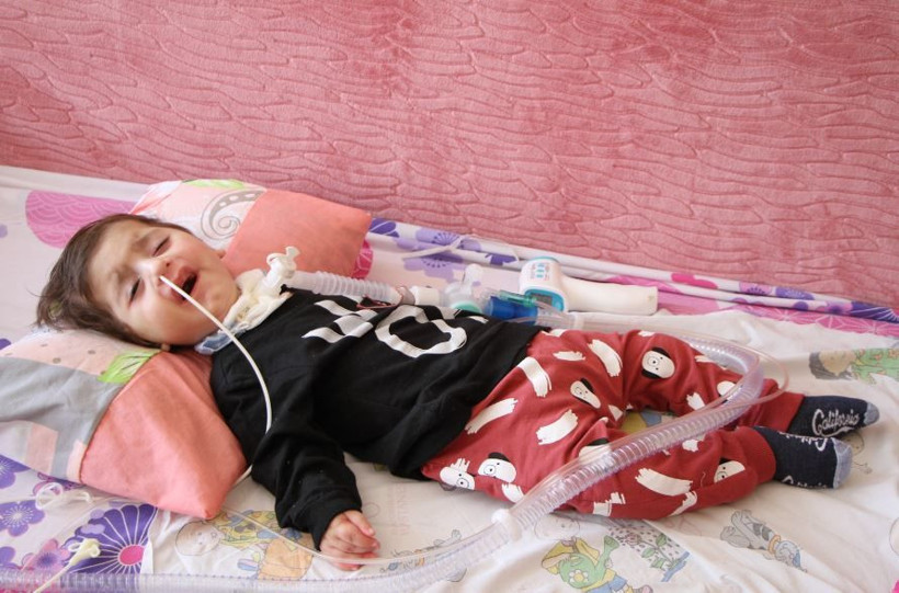 Elazığ'da Efe bebeğin dünyanın en pahalı tedavisine ihtiyacı var! Kalbi 3 defa durdu - Resim: 1