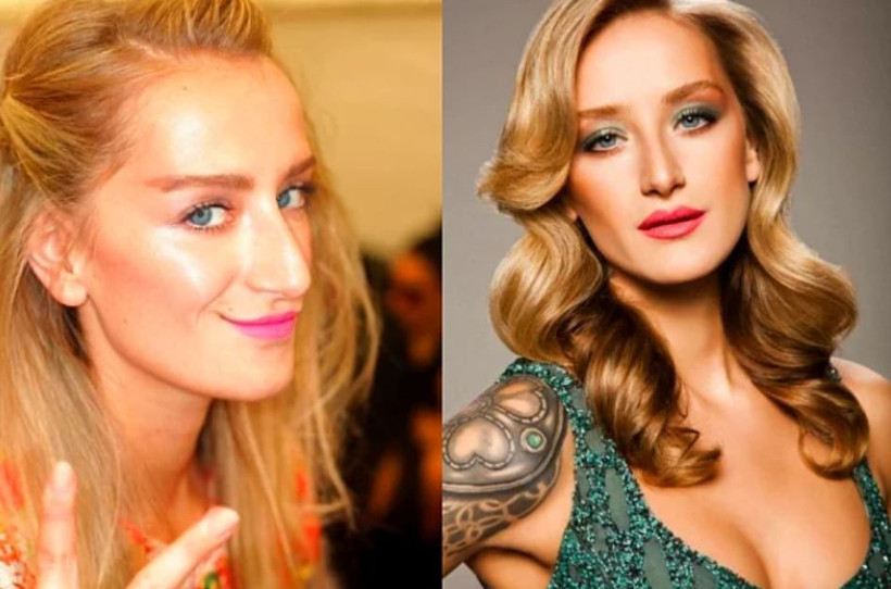 Cansu Dere Demet Özdemir ve Esra Bilgiç'in estetiksiz hallerine bakın - Resim: 3