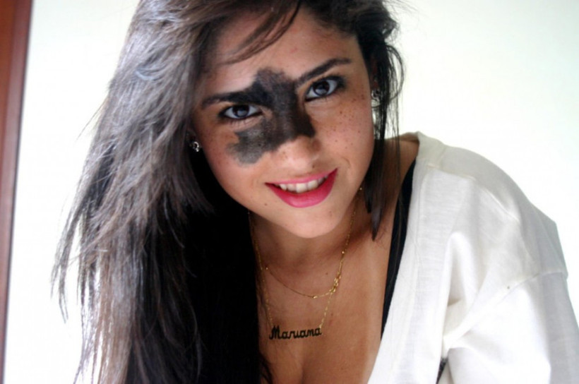 Yüzüyle uzun yıllar dalga geçilen kız model oldu! - Resim: 2