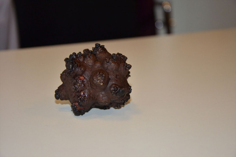 Doktor da şaşkına döndü böylesini ilk kez gördü - Resim: 3