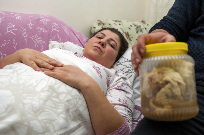 Kanser olabilirsin denildi, karnından çıkanlar şoke etti - Resim: 3