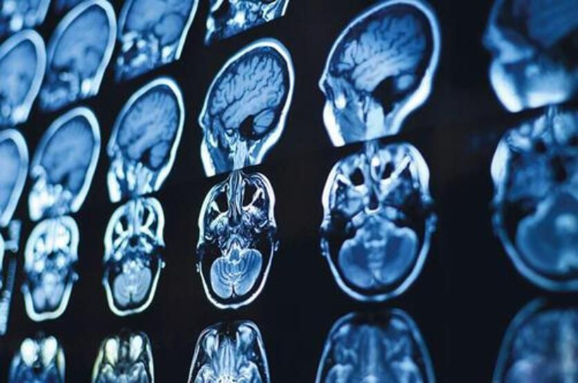 Osman Müftüoğlu'ndan yeni koronavirüs varyantına karşı 4 uyarı! - Resim: 4