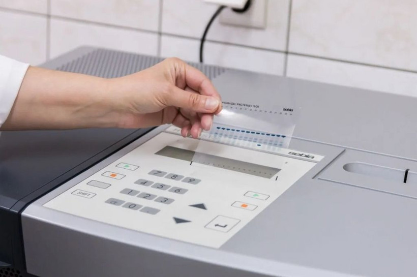 Yeni kabus Langya/LayV virüsünün belirtileri belli oldu - Resim: 2