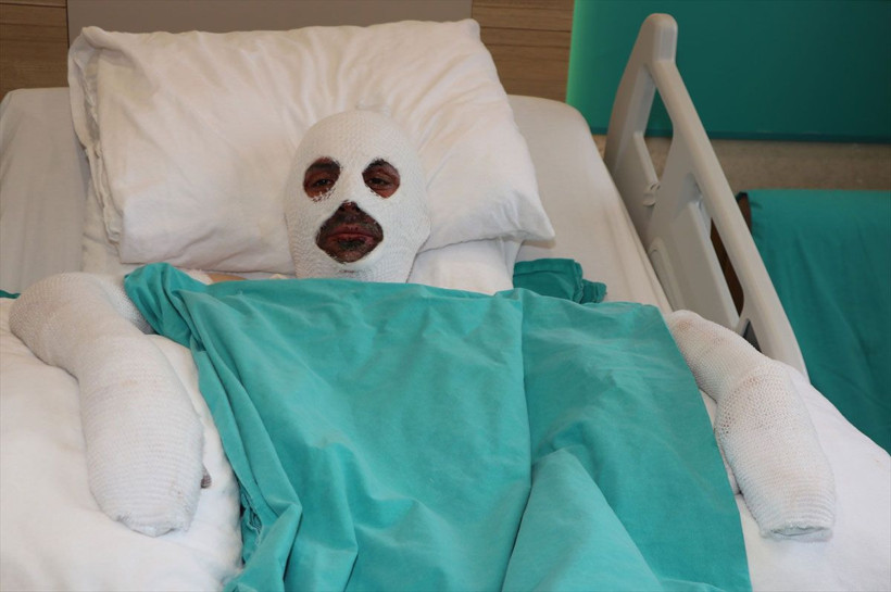 Gazı açıp sohbete dalan döner ustasının başına gelenler feci! - Resim: 1