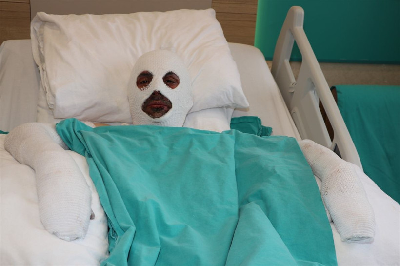 Gazı açıp sohbete dalan döner ustasının başına gelenler feci! - Resim: 4