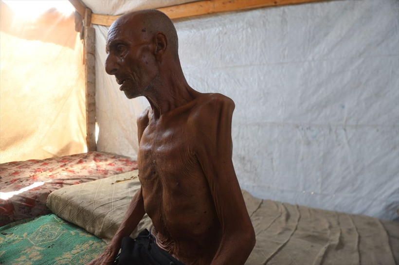 Gazzeli müezzini görenler şoke oluyor 70 kilogramdan bakın kaç kilograma düştü - Resim: 3