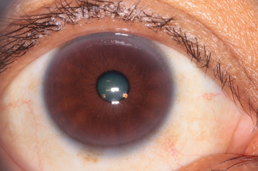 Fotoğrafta beyaz göze dikkat! - Resim: 2