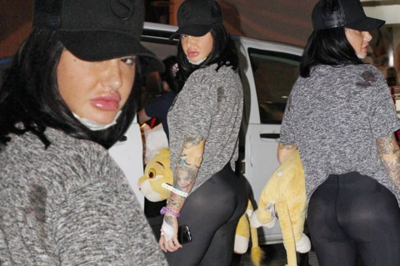 Kalça operasyonu geçirdi, üç hafta oturamayacak! - Resim: 1