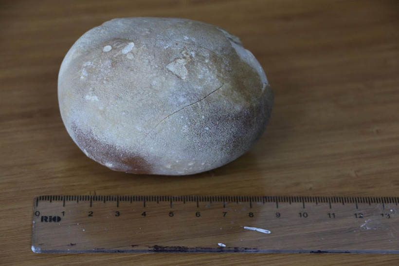 Görünce patates sandı doktor da şaşkına döndü - Resim: 2