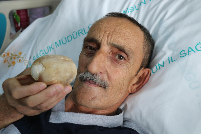 Görünce patates sandı doktor da şaşkına döndü - Resim: 3