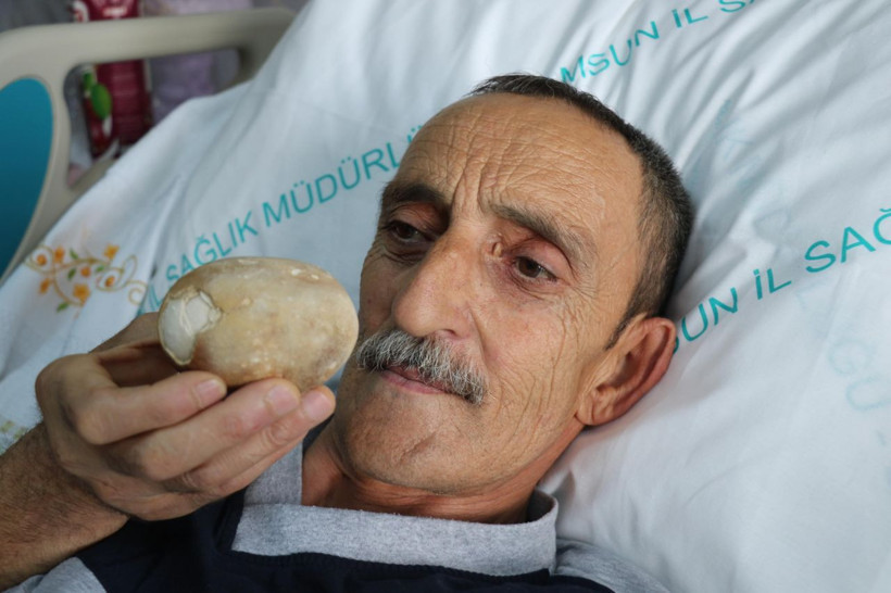 Görünce patates sandı doktor da şaşkına döndü - Resim: 4