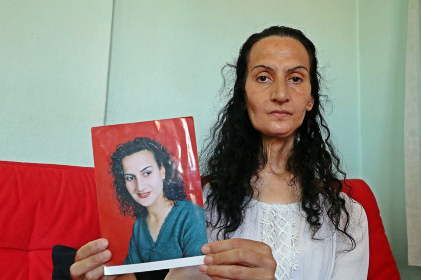 Dil kanserine yakalandı, bacağından parça alıp yeni dil yapıldı - Resim: 2