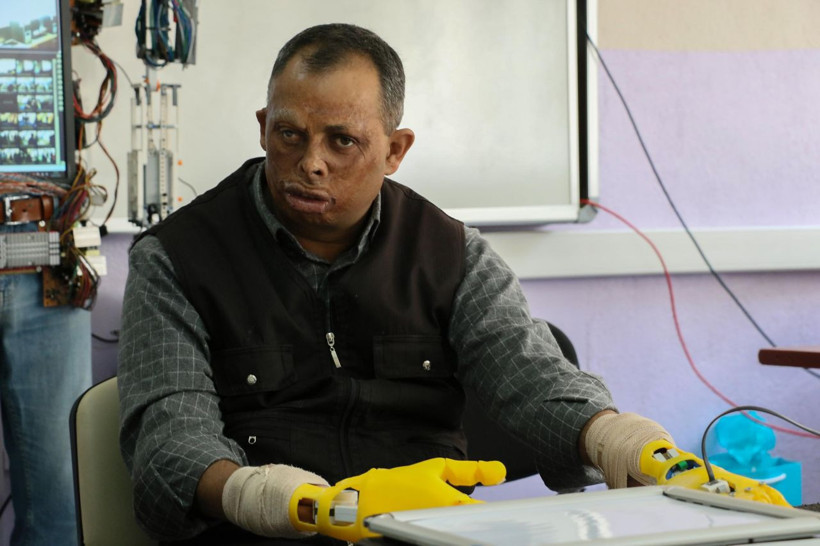 Manisa'da 13 yaşındaki öğrenci arkadaşının babası için protez el yaptı gönülleri fethetti - Resim: 1