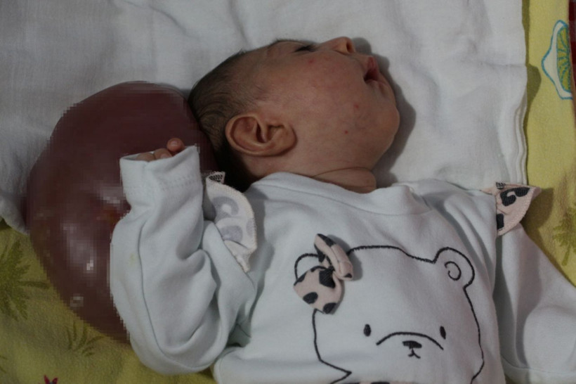 İki kafalı doğdu! Doktorlar yaşamaz dedi - Resim: 4