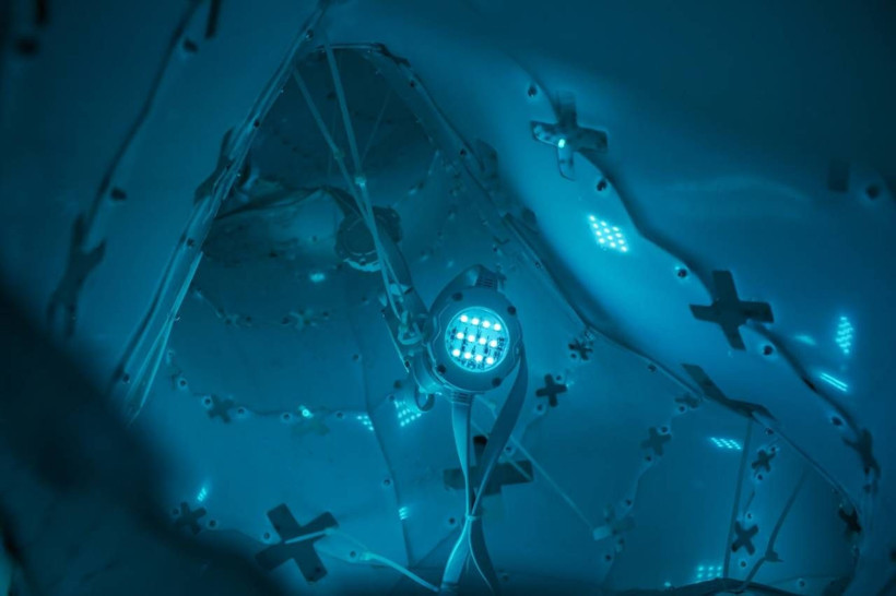 Yapay zekanın yeni marifeti! Twitter’dan gönderilen penis fotoğraflarını bulup siliyor - Resim: 2