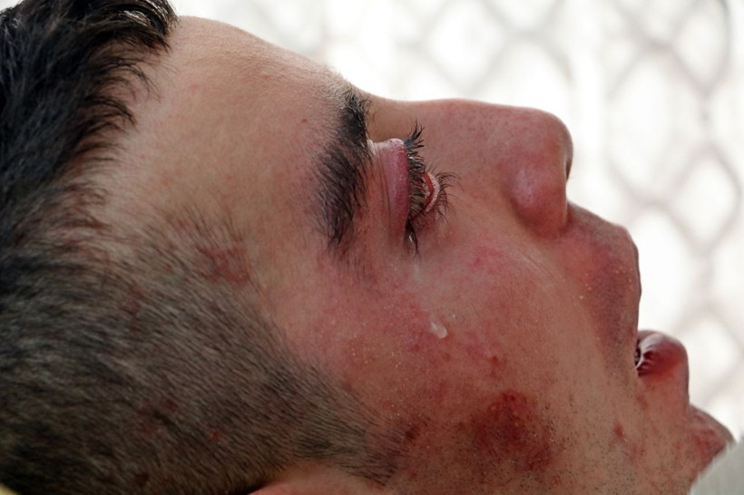 5 yıldır gözlerini kırpamıyor her şey üniversite 2. sınıfta başladı - Resim: 4