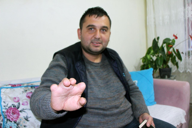 İş kazası geçirince hayatı karardı ayak parmakları eline nakledildi - Resim: 3